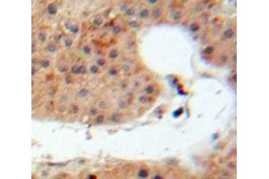 Used in DAB staining on fromalin fixed paraffin-embedded Liver tissue (IL-20 抗体  (AA 25-176))