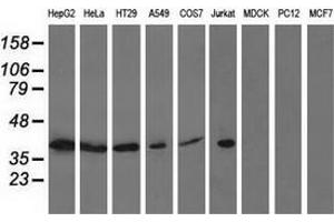 Western blot analysis of extracts (35 µg) from 9 different cell lines by using anti-ACAT2 monoclonal antibody. (ACAT2 抗体)