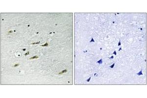 Immunohistochemistry analysis of paraffin-embedded human brain tissue, using JAK2 (Ab-931) Antibody. (JAK2 抗体  (AA 906-955))