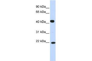 WB Suggested Anti-SSX4 Antibody Titration:  0. (SSX4 抗体  (N-Term))