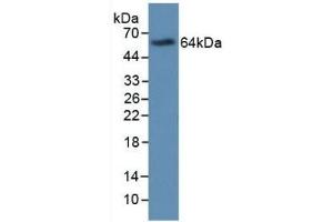 Detection of Recombinant MBP, Human using Monoclonal Antibody to Major Basic Protein (MBP) (Major Basic Protein 抗体  (AA 105-222))