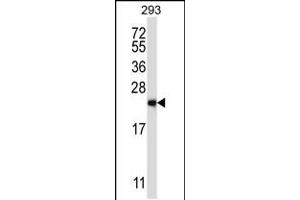Western blot analysis in 293 cell line lysates (35ug/lane). (RAB1B 抗体  (C-Term))