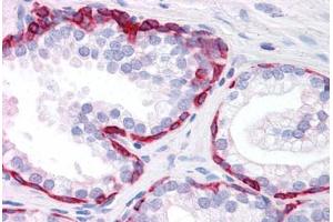 Human Prostate: Formalin-Fixed, Paraffin-Embedded (FFPE) (KRT20 抗体  (AA 1-425))