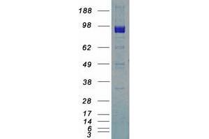 Validation with Western Blot