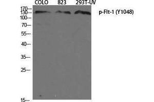 Western Blotting (WB) image for anti-Fms-Related tyrosine Kinase 1 (VEGFR1) (FLT1) (pTyr1048) antibody (ABIN3179813) (FLT1 抗体  (pTyr1048))