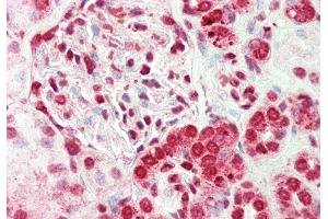 Immunohistochemistry (IHC) image for anti-E74-Like Factor 2 (Ets Domain Transcription Factor) (ELF2) (N-Term) antibody (ABIN2777387)