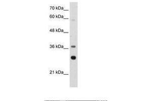 Image no. 1 for anti-Ribosomal Protein, Large, P0 (RPLP0) (AA 182-231) antibody (ABIN203302) (RPLP0 抗体  (AA 182-231))