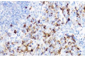 Immunohistochemistry of paraffin-embedded Mouse spleen using YKL-40 / CHI3L1 Polyclonal Antibody at dilution of 1:100 (40x lens). (CHI3L1 抗体)