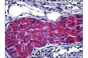 Immunohistochemistry (Paraffin-embedded Sections) (IHC (p)) image for anti-Dihydropyrimidinase-Like 2 (DPYSL2) (C-Term) antibody (ABIN784201)