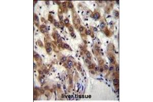 PHF20 Antibody (N-term) (ABIN656095 and ABIN2845438) immunohistochemistry analysis in formalin fixed and paraffin embedded human liver tissue followed by peroxidase conjugation of the secondary antibody and DAB staining. (PHF20 抗体  (N-Term))