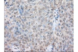 Immunohistochemical staining of paraffin-embedded Human colon tissue using anti-SNX9 mouse monoclonal antibody. (SNX9 抗体)