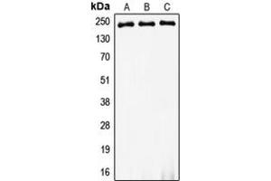 Western blot analysis of Myosin 8 expression in HeLa (A), SP2/0 (B), PC12 (C) whole cell lysates. (MYH8 抗体  (Center))