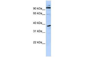 WB Suggested Anti-PHF11 Antibody Titration:  0. (PHF11 抗体  (N-Term))