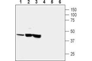 Western blot analysis of human neuroblastoma (SH-SY5Y) (lanes 1 and 4), human brain astrocytoma (CCF-STTGI) (lanes 2 and 5) and rat pheochromocytoma (PC12) (lanes 3 and 6): - 1-3. (CRHR1 抗体  (Extracellular))