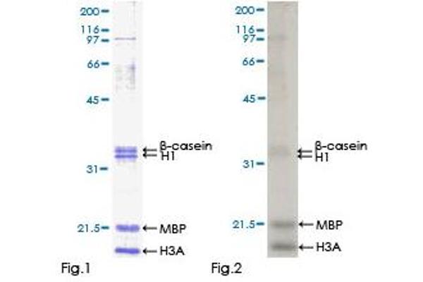 CAMKK1 Protein (AA 1-520) (GST tag)