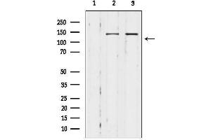 anti-Microtubule Associated serine/threonine Kinase 3 (MAST3) (Internal Region) antibody