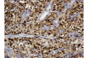 Image no. 7 for anti-Thymidine Phosphorylase (TYMP) (AA 311-482) antibody (ABIN1491396)