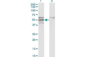 Western Blot analysis of SC65 expression in transfected 293T cell line by SC65 monoclonal antibody (M01), clone 1E12. (Leprecan-Like 4 抗体  (AA 270-379))