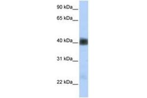 Image no. 1 for anti-Sarcoglycan, beta (43kDa Dystrophin-Associated Glycoprotein) (SGCB) (AA 180-229) antibody (ABIN6740863) (SGCB 抗体  (AA 180-229))