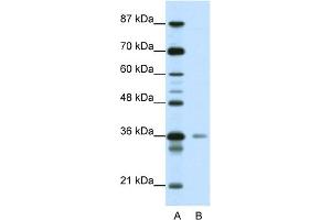 WB Suggested Anti-HMG20A Antibody Titration:  0.