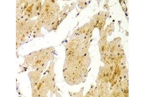 Immunohistochemistry of paraffin-embedded Human esophagus using MVP Polyclonal Antibody at dilution of 1:100 (40x lens). (MVP 抗体)