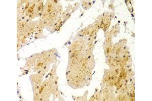 Immunohistochemistry of paraffin-embedded Human esophagus using MVP Polyclonal Antibody at dilution of 1:100 (40x lens).