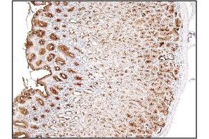 Immunohistochemistry (IHC) image for anti-Mucin 1 (MUC1) (C-Term) antibody (ABIN371859) (MUC1 抗体  (C-Term))