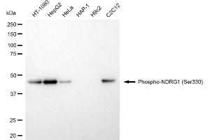 Western blotting analysis using phospho-NDRG1 (Ser330) antibody (ABIN7799537). (Recombinant NDRG1 抗体  (pSer330))