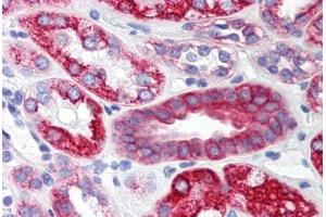 Human Kidney (formalin-fixed, paraffin-embedded) stained with SCO2 antibody ABIN214472 at 2. (SCO2 抗体  (C-Term))