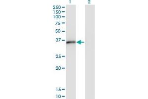Western Blot analysis of MSX2 expression in transfected 293T cell line by MSX2 monoclonal antibody (M10), clone 1E8. (Msx2/Hox8 抗体  (AA 1-133))