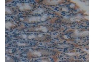 Detection of GSTk1 in Mouse Intestine Tissue using Polyclonal Antibody to Glutathione S Transferase Kappa 1 (GSTk1) (GSTK1 抗体  (AA 19-222))