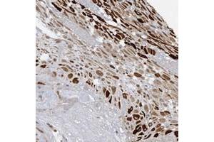Immunohistochemical staining of human placenta with PGBD2 polyclonal antibody  shows strong positivity in decidual cells at 1:10-1:20 dilution. (PGBD2 抗体)