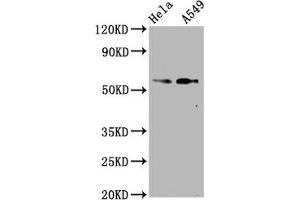 Western Blot Positive WB detected in Hela whole cell lysate,A549 whole cell lysate All lanes Phospho-SMAD2 antibody at 1. (Recombinant SMAD2 抗体  (pSer250))
