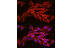 Immunofluorescence analysis of NIH/3T3 cells using SEC61 Rabbit pAb (1614) at dilution of 1:350 (40x lens). (SEC61A1 抗体  (AA 310-420))
