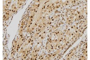 ABIN6277572 at 1/100 staining Human kidney tissue by IHC-P. (NDC80 抗体  (C-Term))