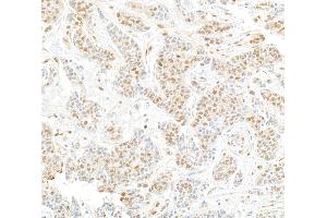 Immunohistochemistry (IHC) image for anti-Cullin 4A (CUL4A) (C-Term) antibody (ABIN7453591) (Cullin 4A 抗体  (C-Term))