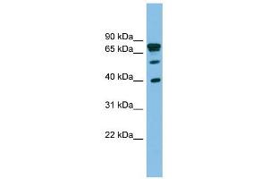LETMD1 antibody used at 1 ug/ml to detect target protein. (LETMD1 抗体  (Middle Region))