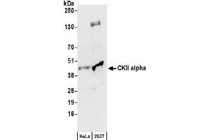 anti-Casein Kinase 2 alpha 1 (CSNK2A1) (AA 1-50) antibody