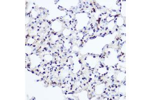 Immunohistochemistry of paraffin-embedded rat lung using NFIA Rabbit pAb (ABIN1681040, ABIN3017626, ABIN3017627 and ABIN6220178) at dilution of 1:200 (40x lens). (NFIA 抗体  (AA 180-330))