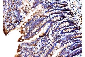 IHC analysis of MLX-interacting protein/MLXIP using anti-MLX-interacting protein/MLXIP antibody (ABIN7602593).