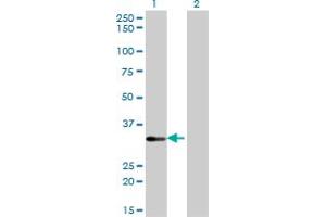 Western Blotting (WB) image for anti-serine/threonine Kinase 16 (STK16) (AA 1-305) antibody (ABIN563708)