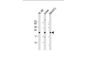 All lanes : Anti-RHOC Antibody (C-term) at 1:2000 dilution Lane 1: HL-60 whole cell lysate Lane 2: Jurkat whole cell lysate Lane 3: NIH/3T3 whole cell lysate Lysates/proteins at 20 μg per lane. (RHOC 抗体  (C-Term))
