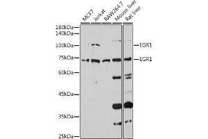 Western blot analysis of extracts of various cell lines, using EGR1 antibody (ABIN3016527, ABIN3016528, ABIN3016529 and ABIN1679679) at 1:1000 dilution. (EGR1 抗体)