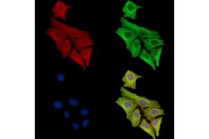 ABIN7097103 and ABIN7101170 staining Hela cells by IF/ICC. (Dolichol Kinase 抗体)