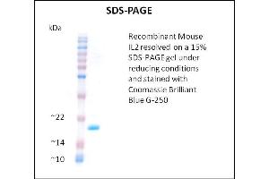 SDS-PAGE (SDS) image for Interleukin 2 (IL2) (Active) protein (ABIN5509345) (IL-2 蛋白)