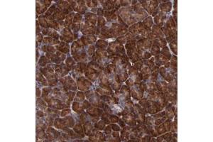 Immunohistochemical staining of human pancreas with USP51 polyclonal antibody  shows strong cytoplasmic positivity in exocrine glandular cells at 1:50-1:200 dilution. (USP51 抗体)