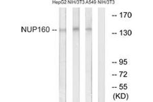 Western blot analysis of extracts from NIH-3T3/A549/HepG2 cells, using NUP160 Antibody. (NUP160 抗体  (AA 392-441))