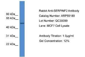 WB Suggested Anti-SERPINF2  Antibody Titration: 0. (alpha 2 Antiplasmin 抗体  (N-Term))