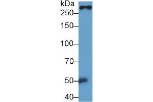 Detection of FN in Rat Serum using Monoclonal Antibody to Fibronectin (FN) (Fibronectin 抗体  (AA 355-558))
