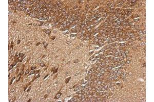 IHC-P Image Immunohistochemical analysis of paraffin-embedded CL1-5 xenograft, using RPL29, antibody at 1:500 dilution. (RPL29 抗体)